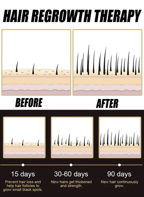 2026  latest technology new products Anti-hair Loss Essence Promotes Hair Growth and Improves The Scalp Environment